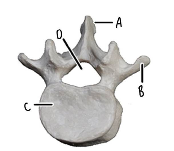 <p>What vertebrae is this and label it</p>