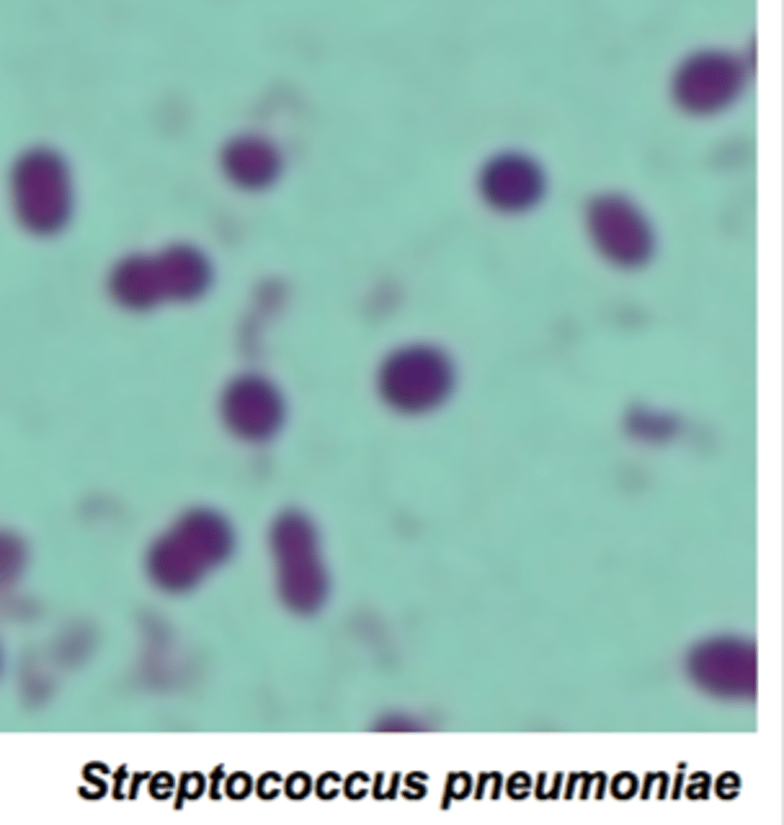 <p>1. Seventy percent of people are healthy nasopharyngeal carriers</p><p>2. Also causes pneumonia and otitis media (infection of the middle ear)</p><p>3. Most common in children (1 month to 4 years)</p><p>4. Mortality: 8% in children, 22% in the elderly</p>