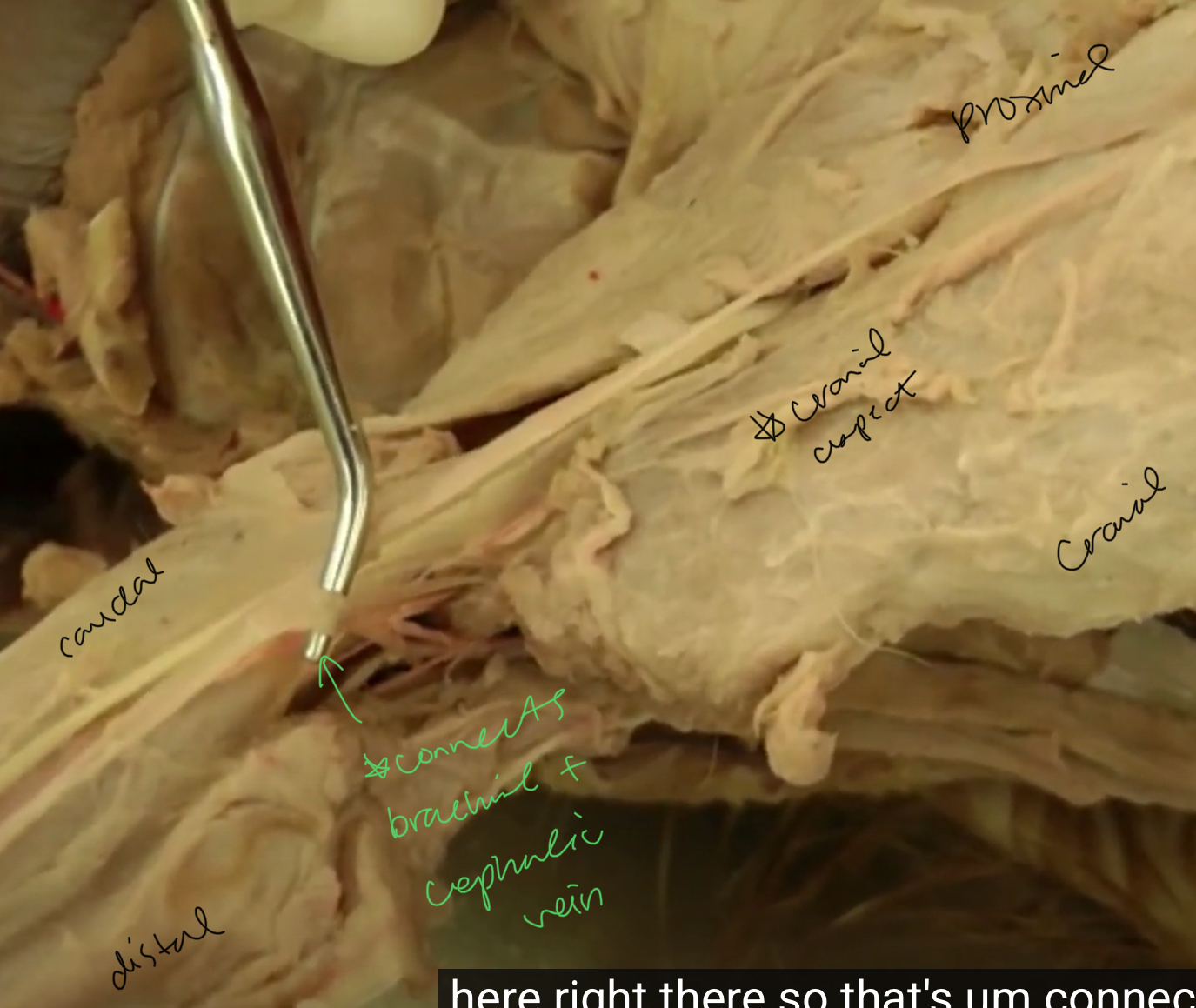 <p>what is being pointed to?</p>