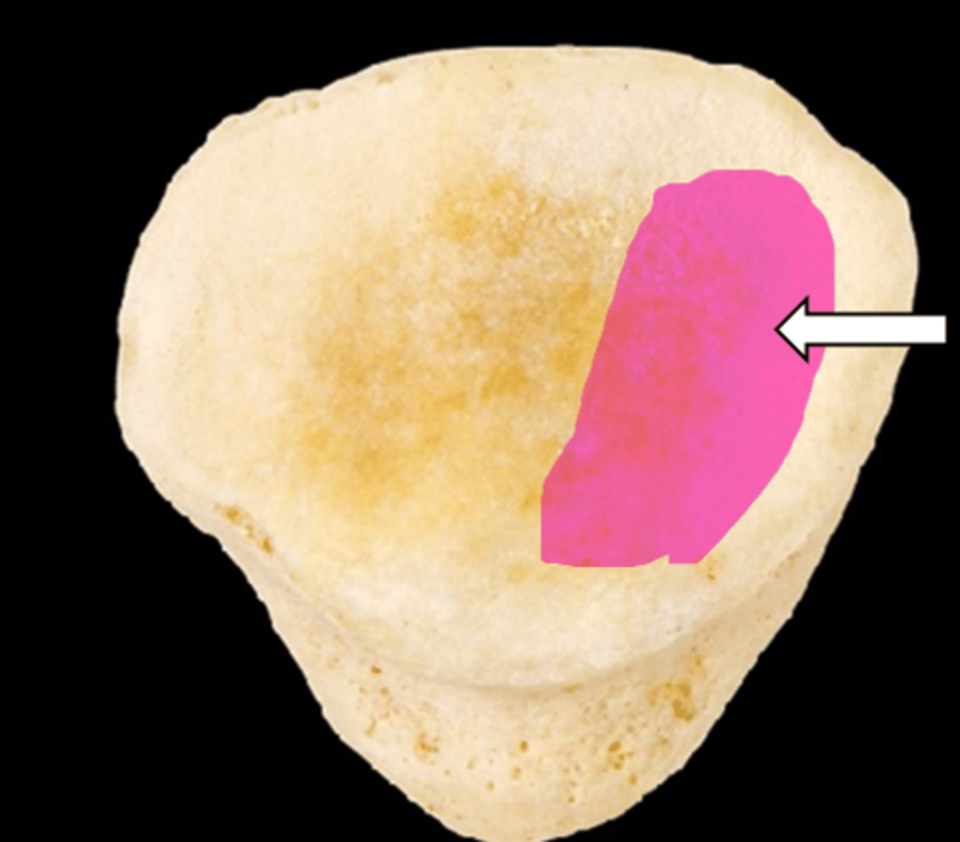 <p>name the part</p>
