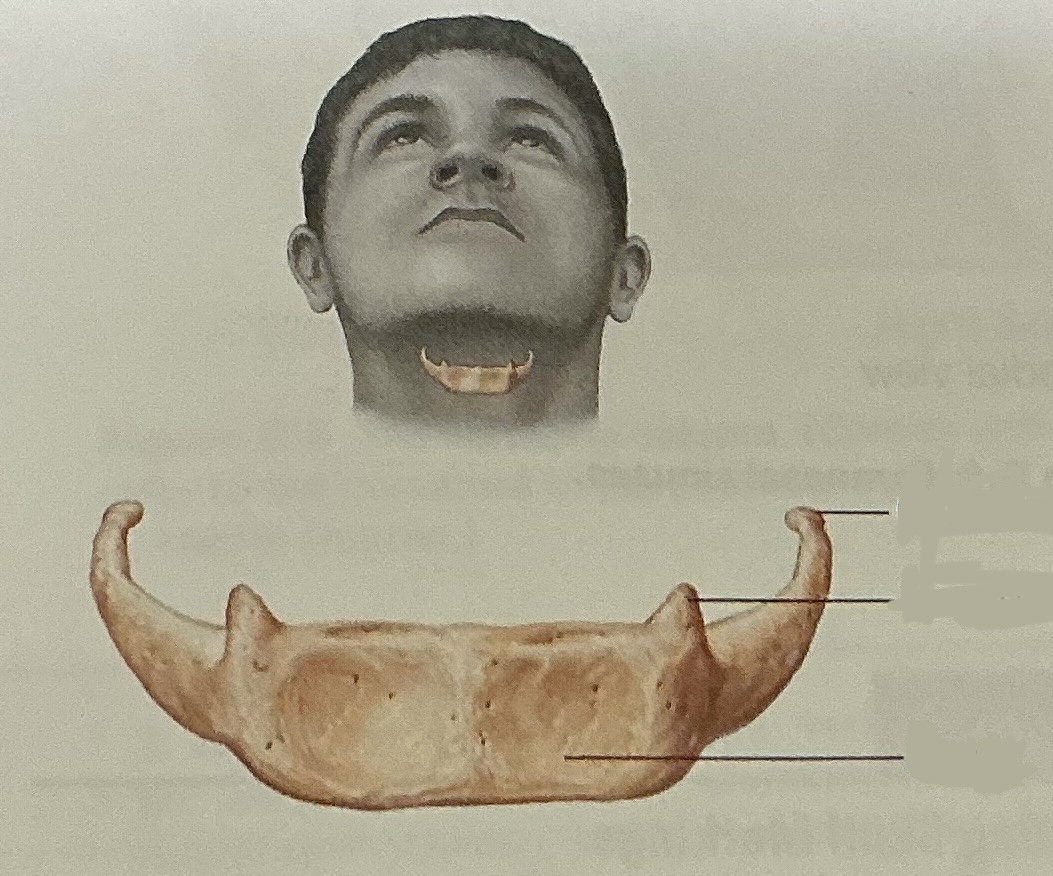 <p>What bone is this?</p>