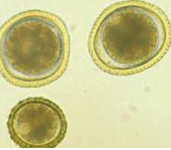 <p> </p><p>List the egg TYPE for the nematode egg shown. </p>
