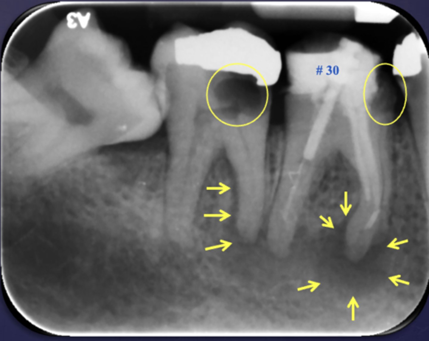 <p>What condition?</p>