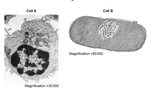 <p>Contrast the structure of the two cells visible in the electron micrographs shown in Figure 14</p>