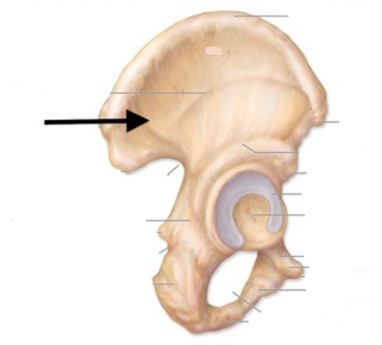 <p>The arrow is pointing to?</p>