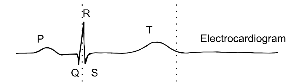 Electrocardiogram