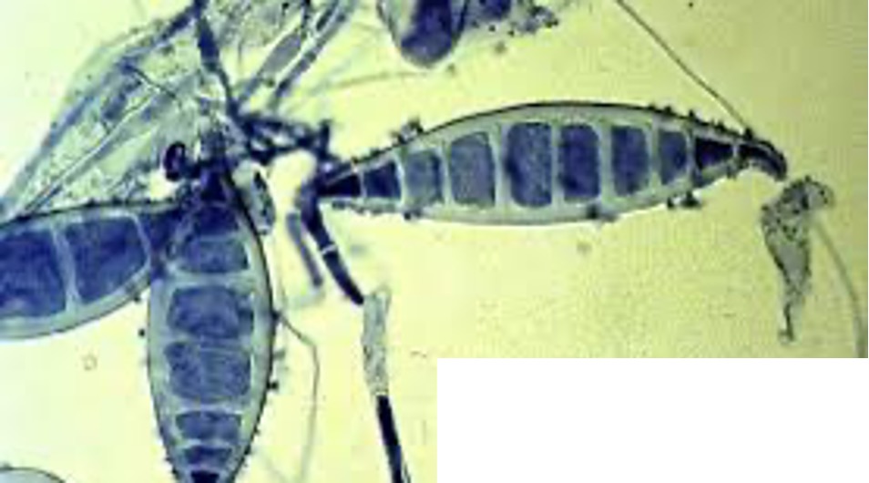 <p>What is the parasite shown in the image?</p><p>Utilize the following characteristics:</p><p><span>•There are usually more than 6 partitions (cells) within each macroconidia – commonly 9.&nbsp;</span></p><p><span>•Note the thick walls around each macroconidia.</span></p>