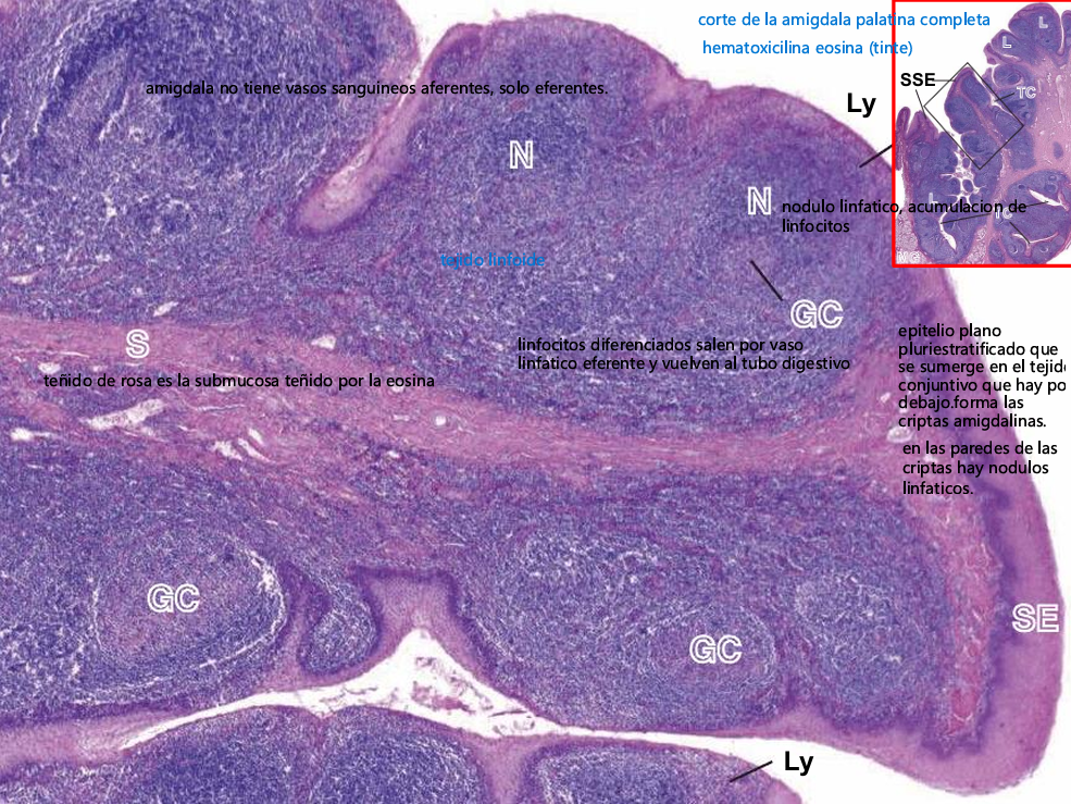 <p>Amígdala de humano</p><ul><li><p>N - Nódulo linfático</p></li><li><p>S - submucosa</p></li><li><p>CG - centro germinativo</p></li><li><p>Ly - linfocitos</p></li></ul><p></p>