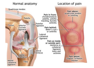 <p>Patellar subluxation/dislocation </p><p>Chondromalacia patella </p><p>Patellar tendonitis - AKA Osgood-Schlatter Disease </p><p>Fracture </p>