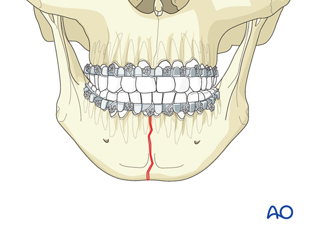 <p>Name the portion highlighted in red.</p>