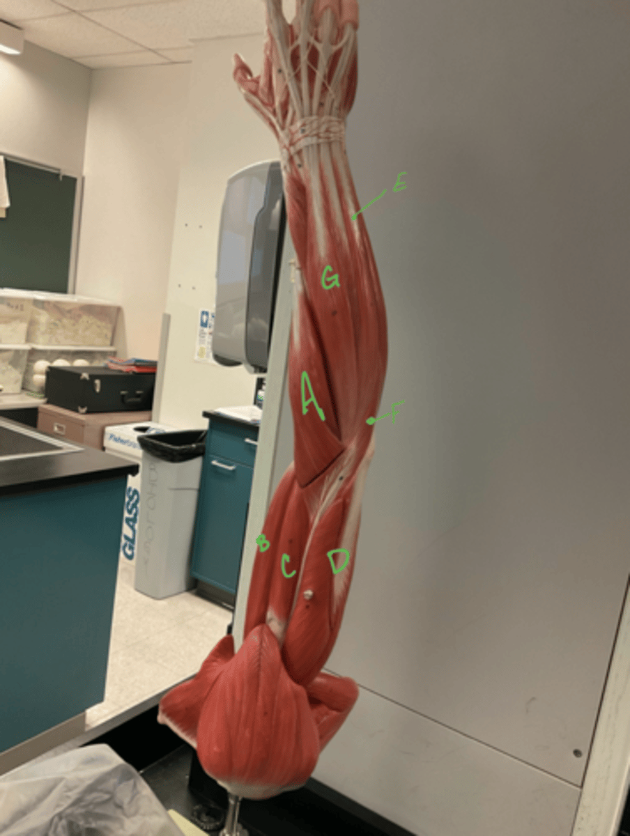 <p>Triceps brachii</p>