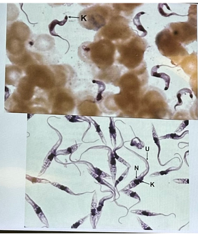 <p>Trypanosoma cruzi infectious stage</p>