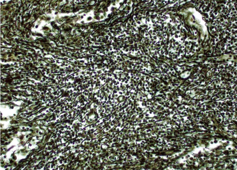 <p>what tissue is this</p>
