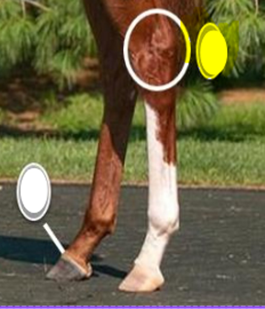 <p>What is body part is indicated on the image</p>