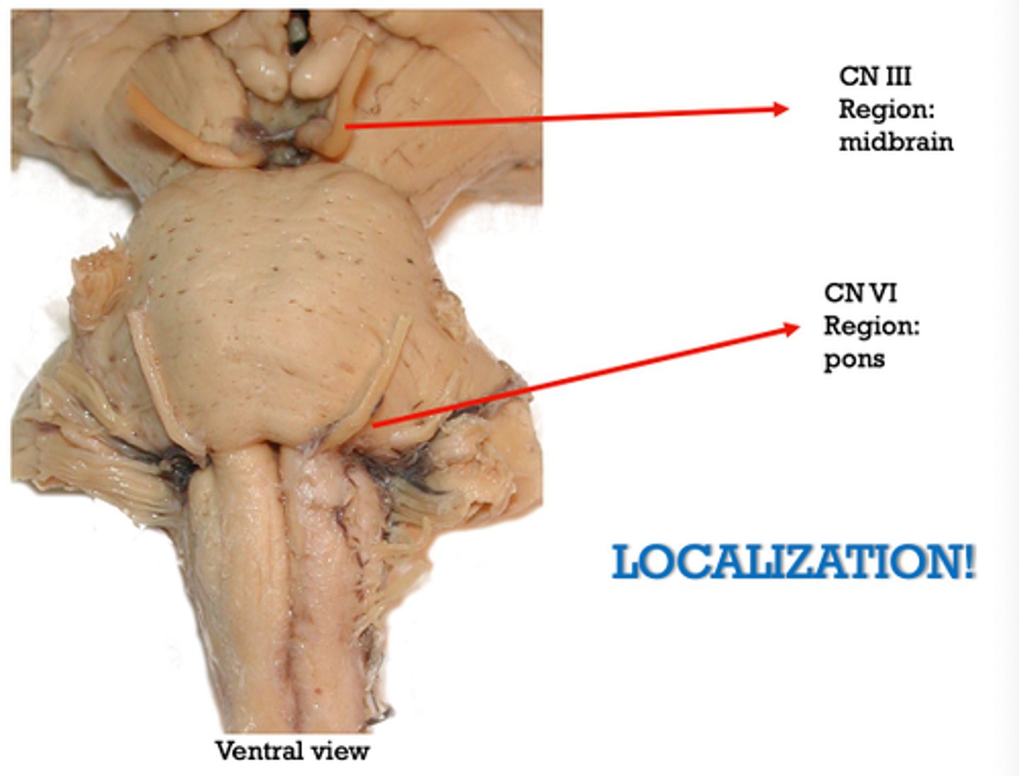 <p>midbrain</p><p>(visible from ventral view)</p>