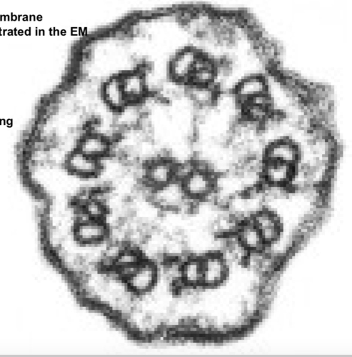 <p>Identify the apical membranemodification demonstrated in the EM</p>