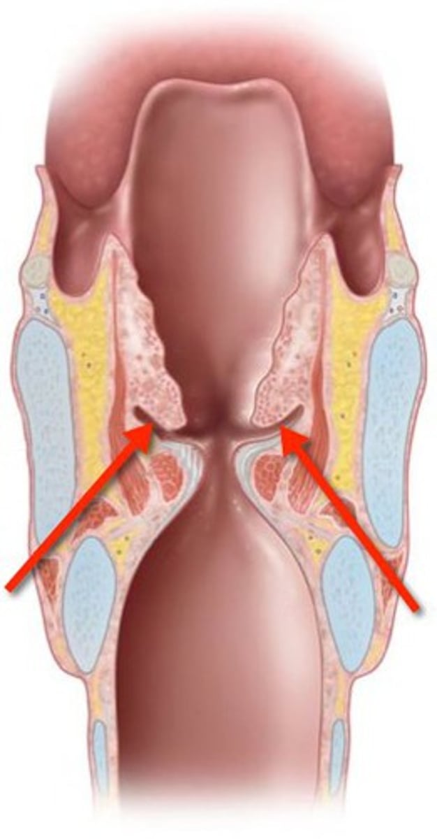 <p>space between true and false vocal folds</p>