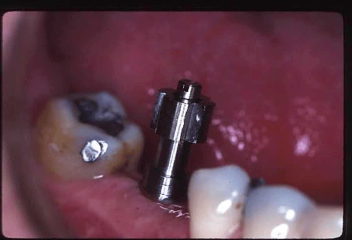 <p>ID the technique and describe what is going on/next steps?</p>