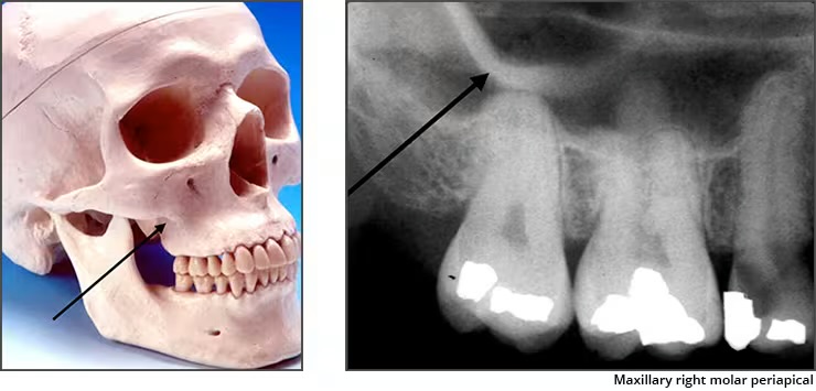 <p>Zygomatic Process (malar process)</p>