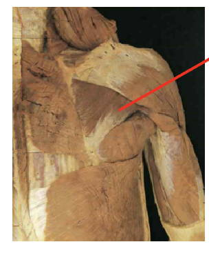 <p>What muscle is this What is its origin. Where does it inserts.</p>