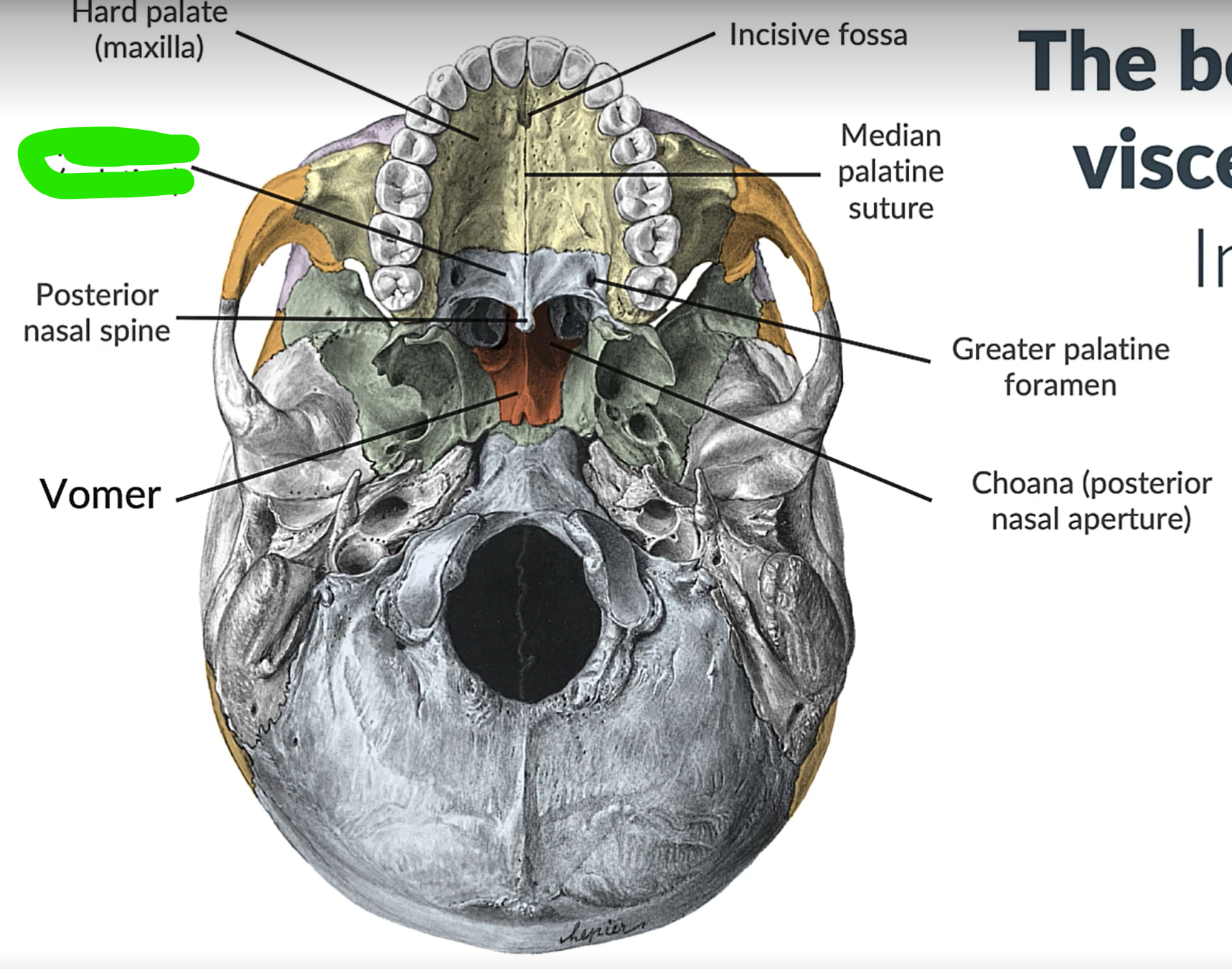 term image