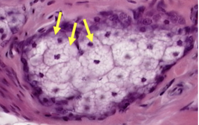 <p>What gland is visible in this specimen?</p>