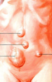 <p>identify the types of hernias</p>