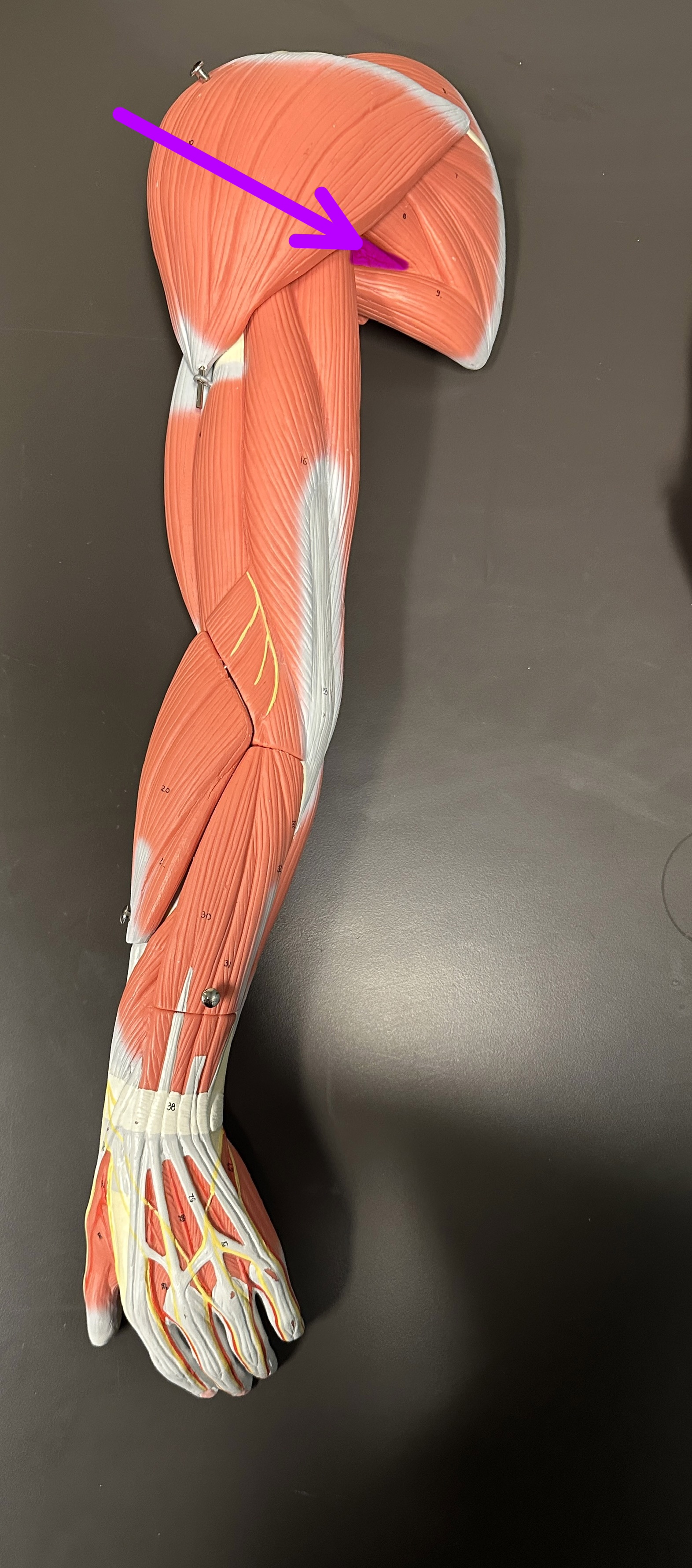 <p>What is the highlighted structure</p>