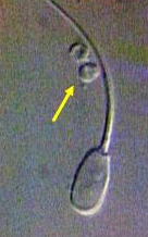 <p>Identify the sperm morphology.</p>