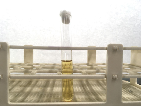 <p>What is the evidence of bacterial growth that can be seen in this culture medium?</p>