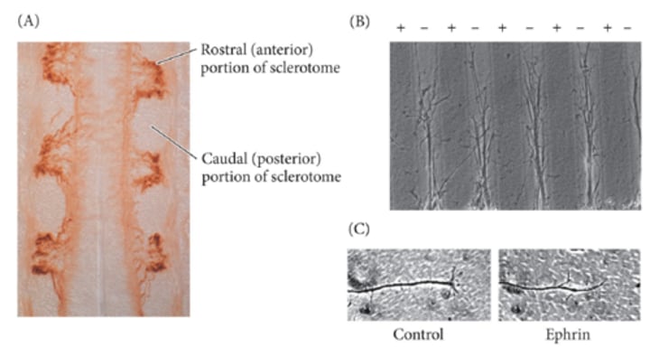 <p>Repulsion of dorsal root ganglions is facilitated by ephrins, found in the posterior sclerotome and interact with Eph receptors. Ephrin is an inhibitory factor of the dorsal root ganglion --&gt; ensures that the dorsal root ganglion only moves into the anterior part, regulating patterning.</p>