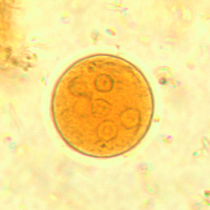 <ul><li><p>10-25 um </p></li><li><p>2-8 nuclei</p></li><li><p>large, eccentric karyosome</p></li><li><p>splinter shaped chromatoidal bars</p></li></ul><p></p>