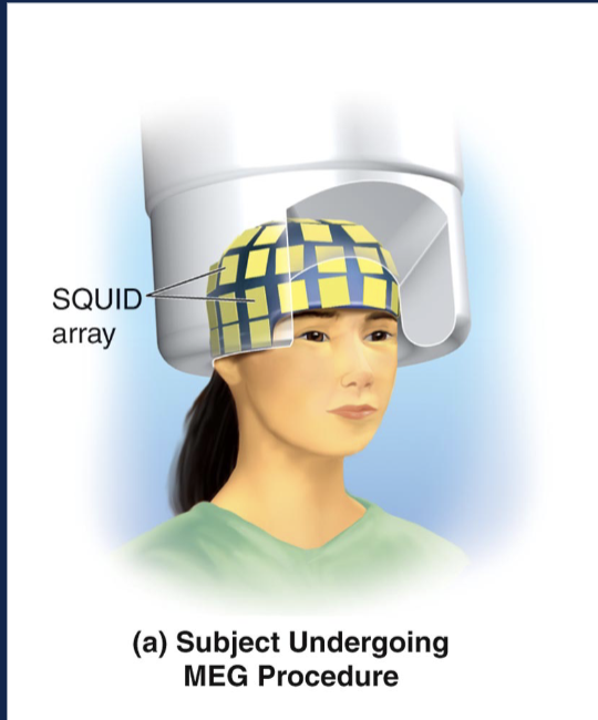 * allows researchers to record the brains magnetic activity
* brains magnetic output is assessed 
* skull is transparent to magnetism, not electricity, making MEG superior to EEG 