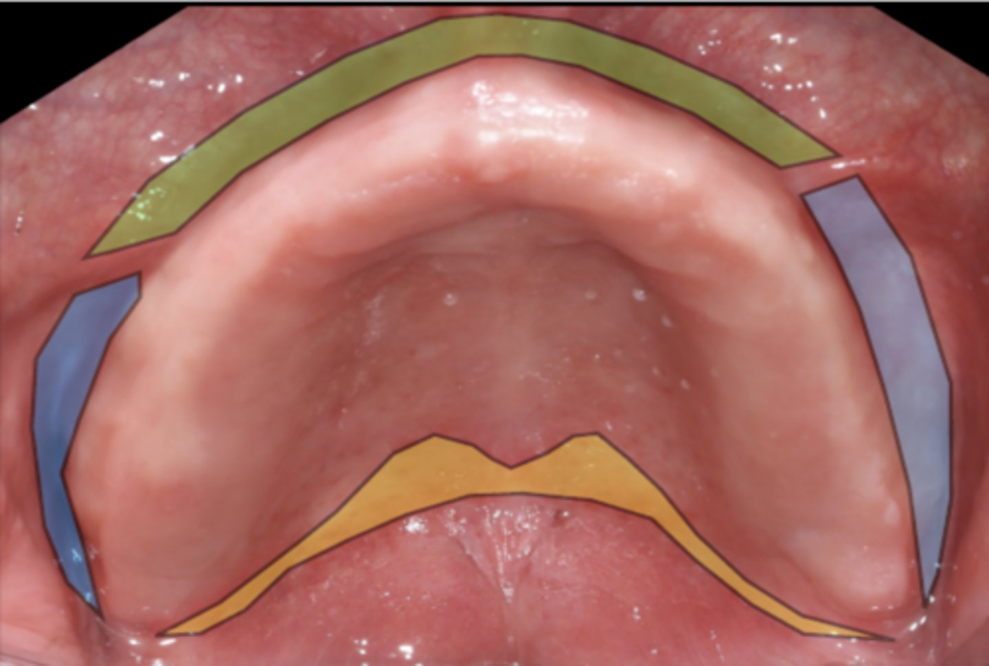 <p>ID the area in blue:</p>