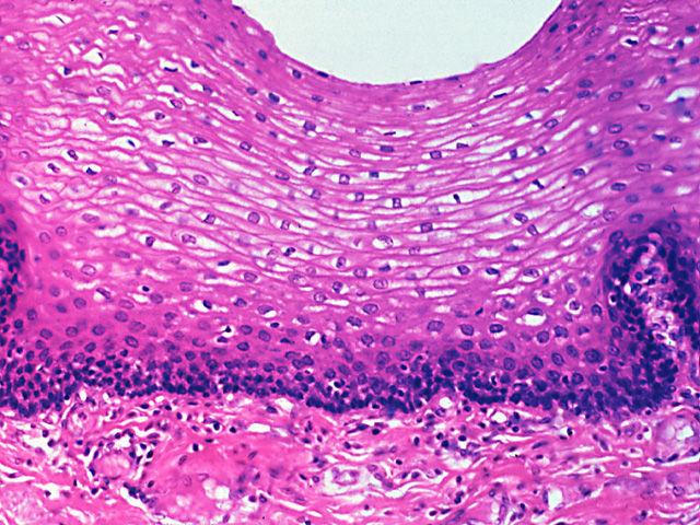 <p>stratified squamous location</p>