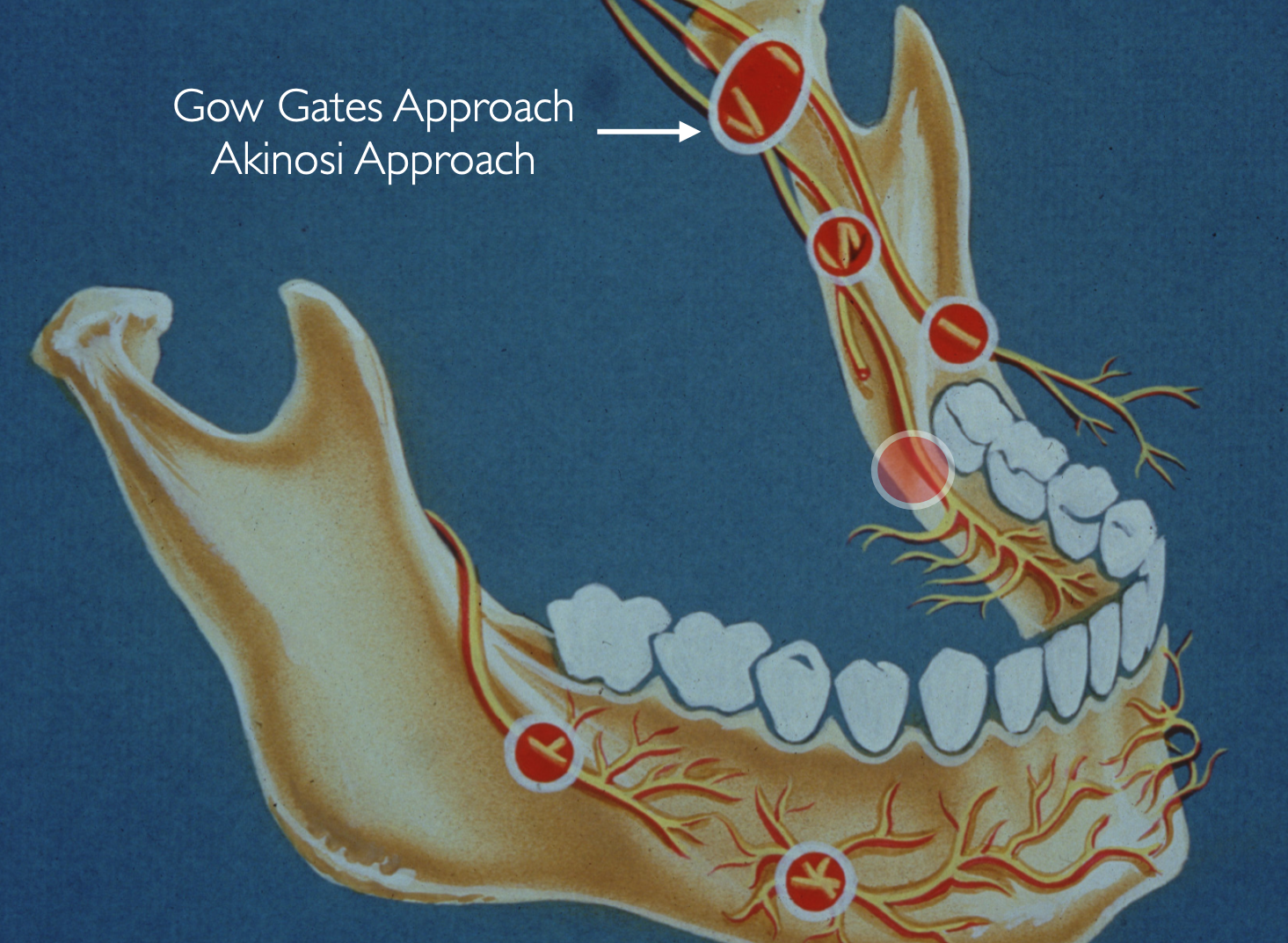 knowt flashcard image
