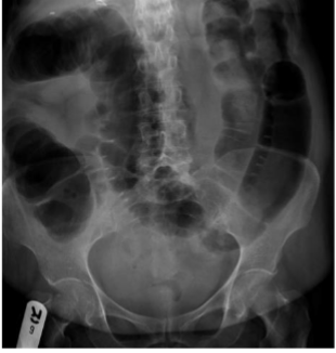 <p>What is this </p>