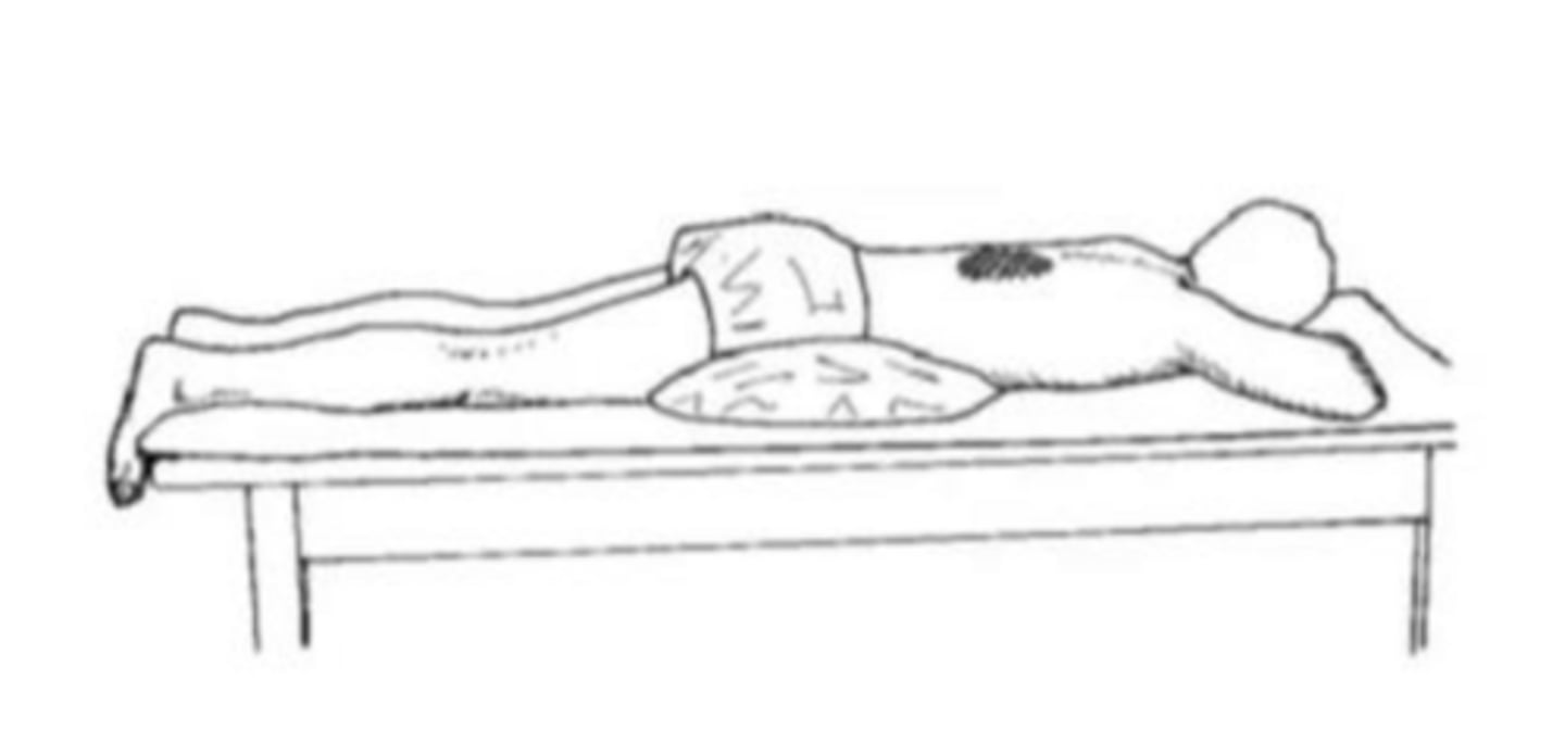 <p>patient lies prone with a pillow under the abdomen to flatten the back; percussion is applied bilaterally directly below the scapulae</p>