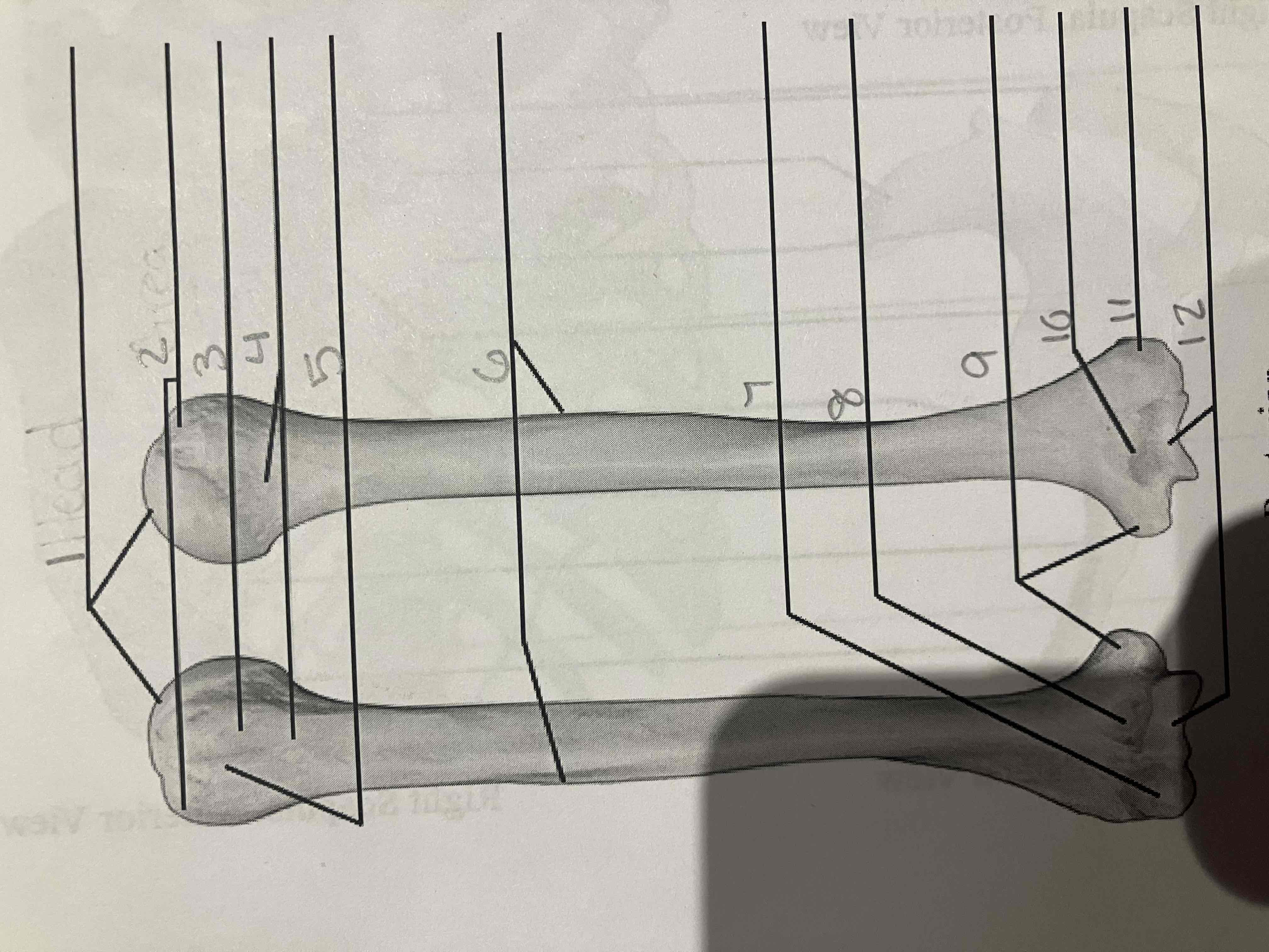 <p>Which bone is the anterior view and which is the posterior view?</p>