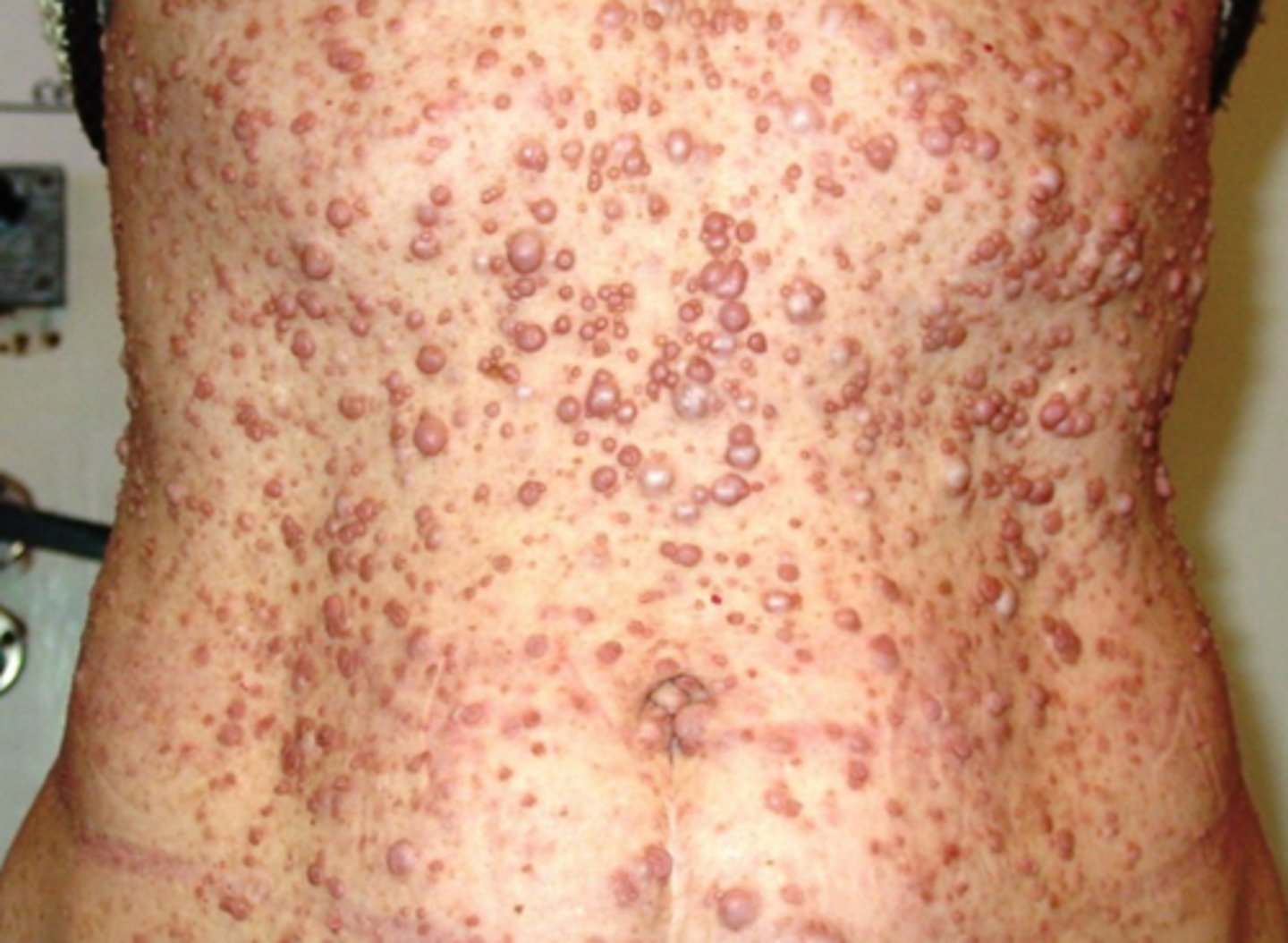 <p>What is the diagnosis?</p>