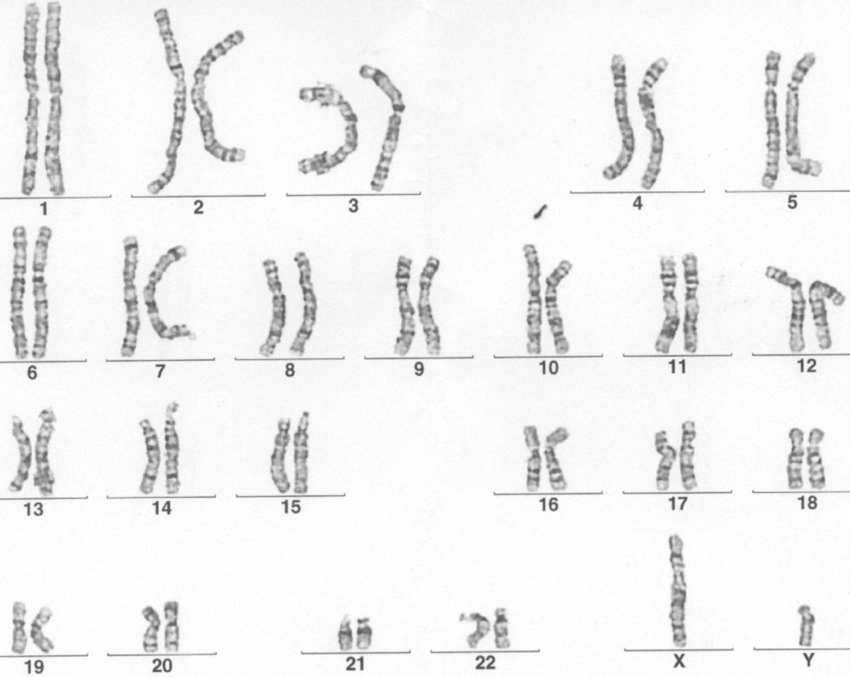 <p>„Chromosomenkarte“</p>