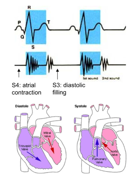 <p>auscultation: listening to internal body sounds</p><p></p><ul><li><p>S1 “lubb” → closure of AV valves</p><ul><li><p>sound from blood hitting closed valve</p></li></ul></li></ul><p></p><ul><li><p>S2 “dubb” → closure of semilunar valves</p><ul><li><p>early ventricular diastole</p></li></ul></li></ul><p></p><ul><li><p>murmur → regurgitation of ventricular blood back into atria</p><ul><li><p>slight backflow→ malformed AV valve</p></li></ul></li></ul><p></p><ul><li><p>Bruit → abnormal sound as blood runs past obstruction through arteries</p></li></ul><p></p><p>ECG →</p><ul><li><p>P wave</p><ul><li><p>atrial depolarization → atrial systole</p></li><li><p>at end of ventricular diastole</p></li></ul></li></ul><p></p><ul><li><p>QRS complex</p><ul><li><p>ventricular depolarization → ventricular systole</p></li></ul></li></ul><p></p><ul><li><p>T wave</p><ul><li><p>ventricular repolarization → end of systole →beginning of ventricular diastole</p></li></ul></li></ul><p></p>