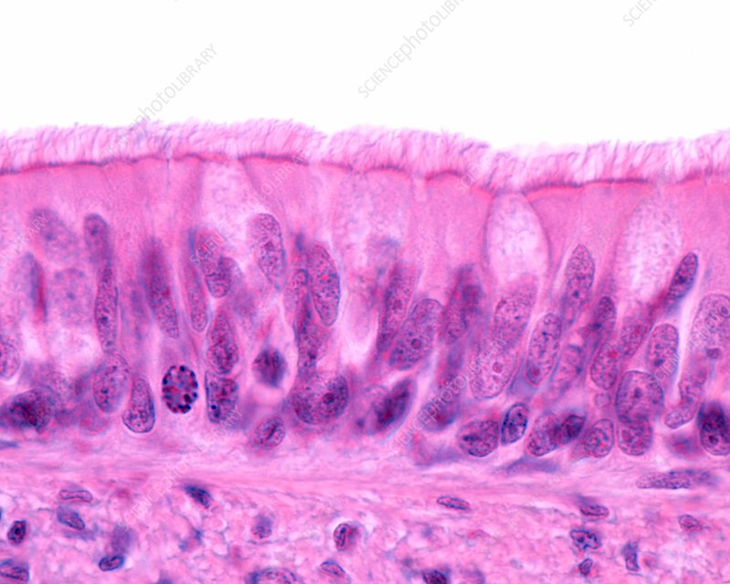 <p>Pseudo-stratified Columnar (PCC)(Epithelial) </p>