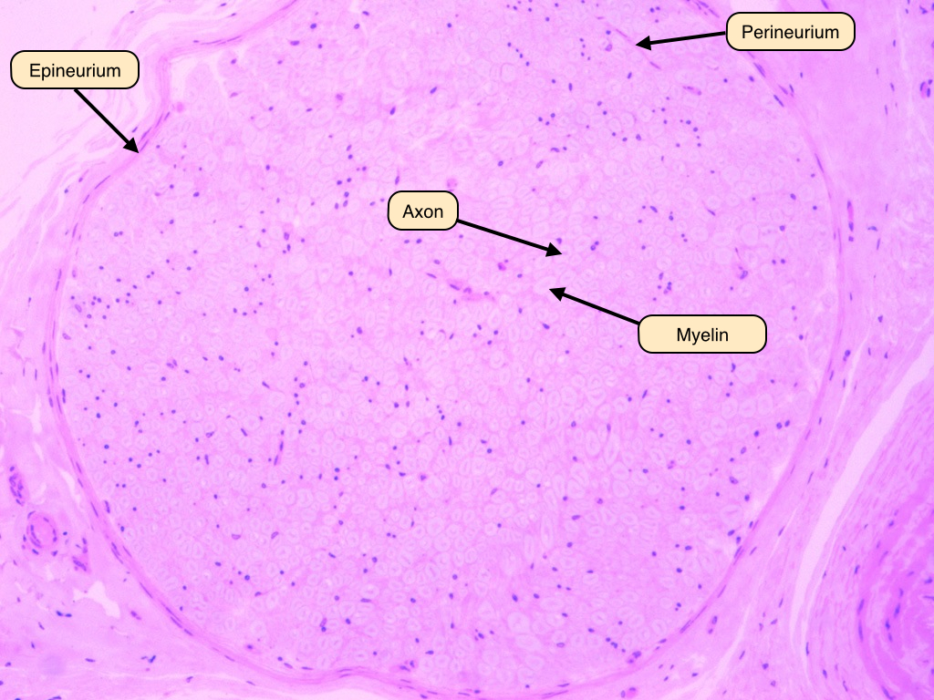 <p>The depicted microscopic slide shows a _______</p>