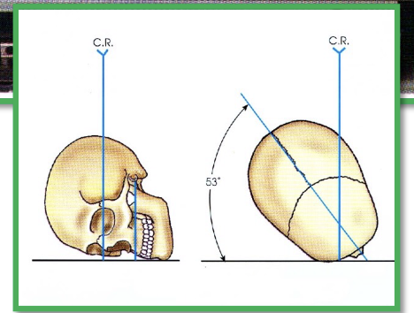 <p>Rhese view - Median sagittal 53 degrees to IR. AMBL perpendicular to IR. Enter 1” superior and 1” posterior to ear attachment.  </p>