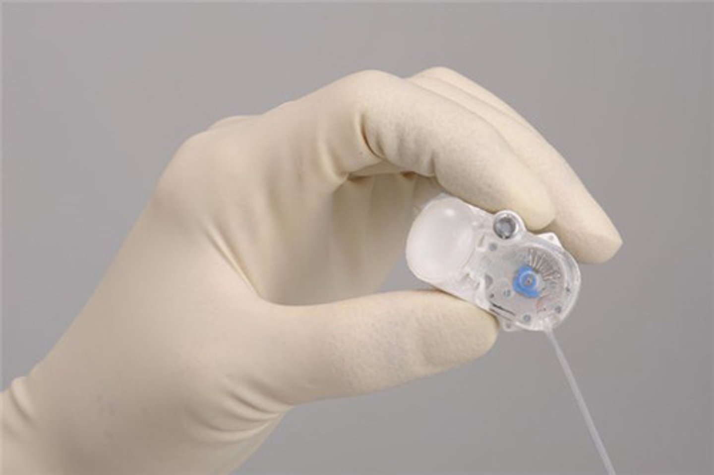 <p>An implanted pump that delivers drug via a needle (Insulin pump)</p>