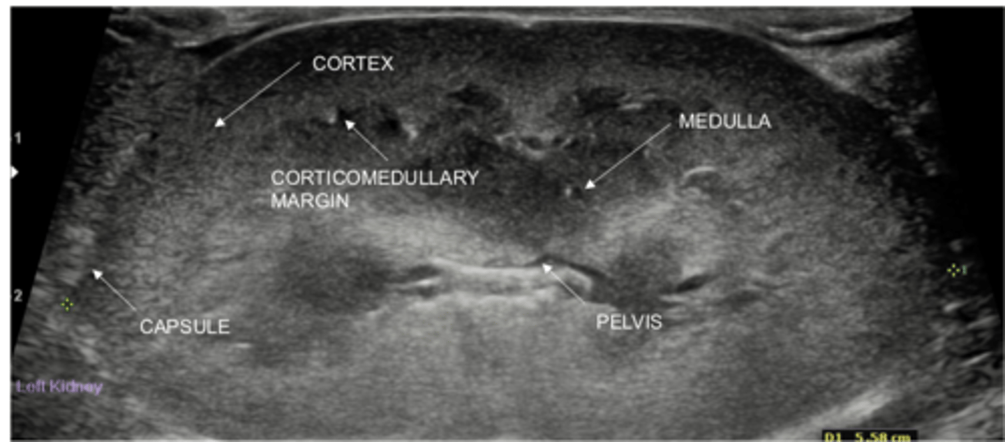 <p>Shape: oval in dogs, more rounded in cats</p><p>Cortex: more hyperechoic</p><p>Medulla: more hypoechoic</p><p>Renal pelvis: v-shape, hypoechoic, up to 2 mm</p><p>Size: variable in dogs, 3.0-4.5 cm length in cats</p>