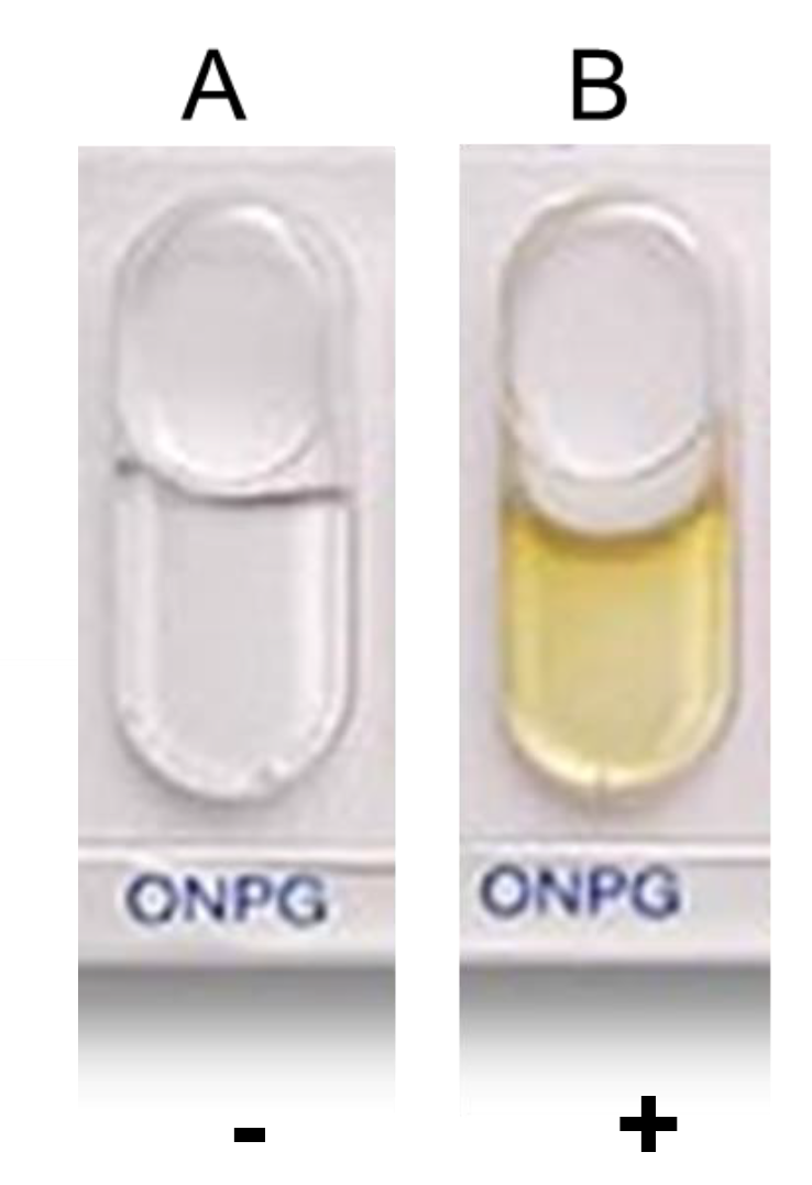 <p>To determine if bacteria can produce beta-galactosidase. </p><p>Positive test will turn yellow. Clear is negative.</p>