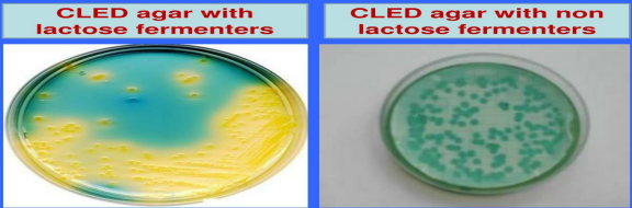 <p>bromothymol blue </p><p>used in culture of urine samples LF (yellow) NLF (pale yellow)</p><p>its an indicator media</p>