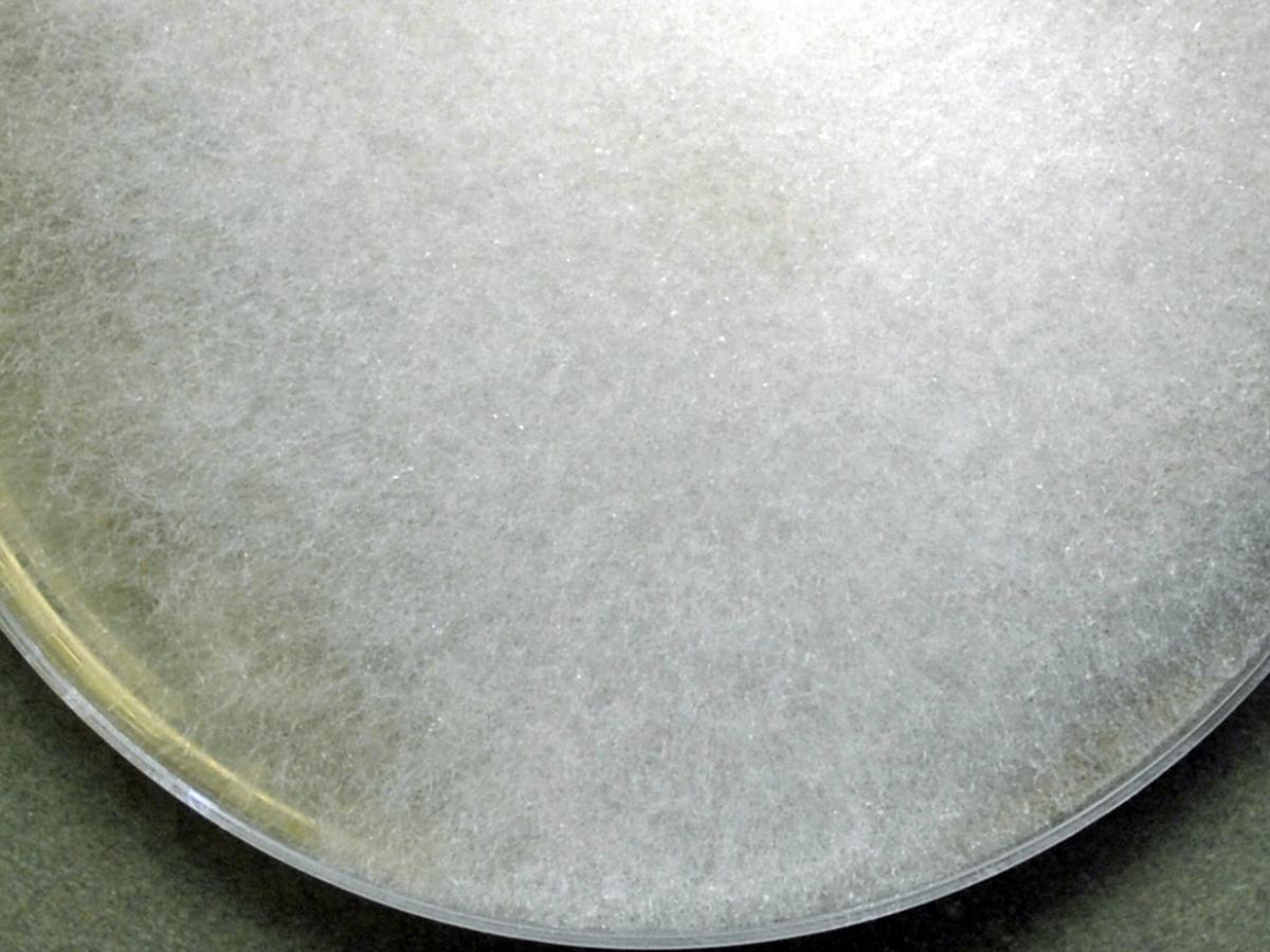 <p>Identify this fungus</p>